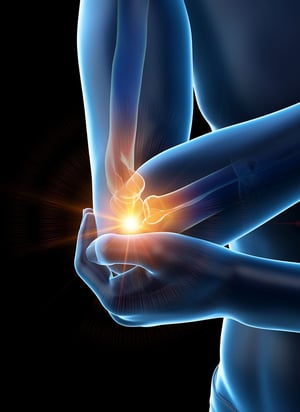 Medical illustration highlighting elbow joint pain and inflammation, commonly treated with physical therapy to improve mobility and reduce pain.