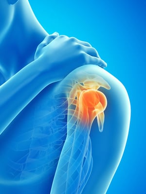 Illustration of shoulder joint pain highlighting inflammation, commonly treated with physical therapy for shoulder injuries.