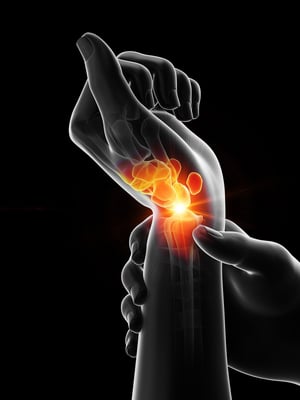 Wrist joint inflammation highlighted in hand.