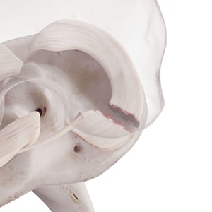 Medical illustration of a shoulder joint showing cartilage damage.