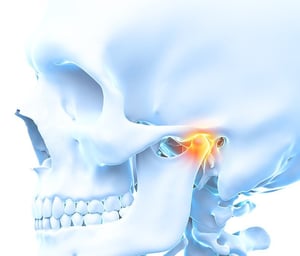 Illustration showing temporomandibular joint (TMJ) inflammation and jaw pain.