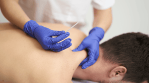 A man being dry needled for neck pain